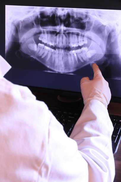 Best Tooth Infection Emergency Dentist  in Coulee Dam, WA